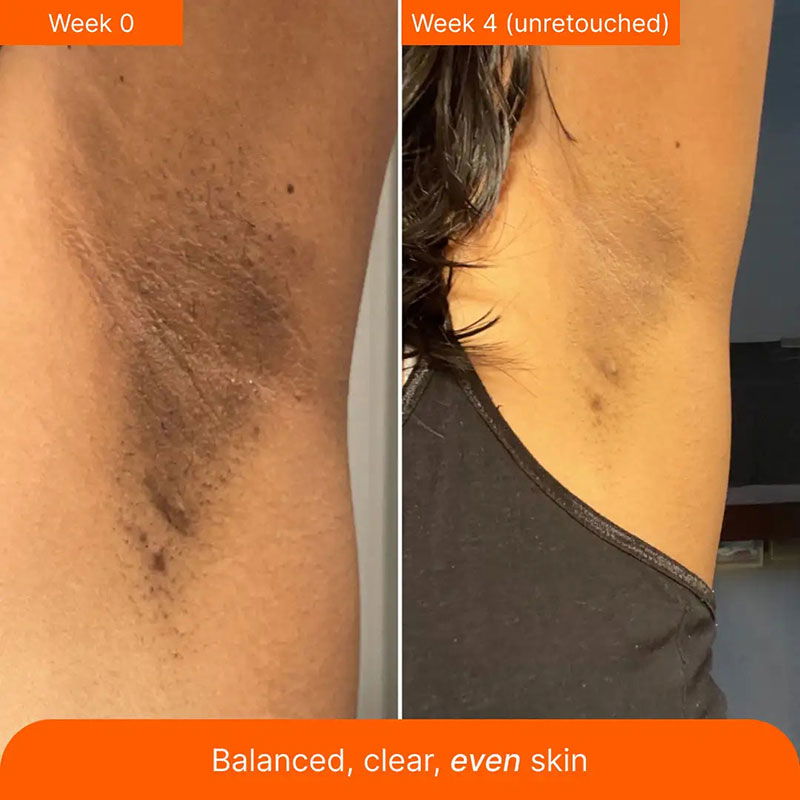 Turmeric Lemon Kojic Acid Soap Bar - YezNatural.com