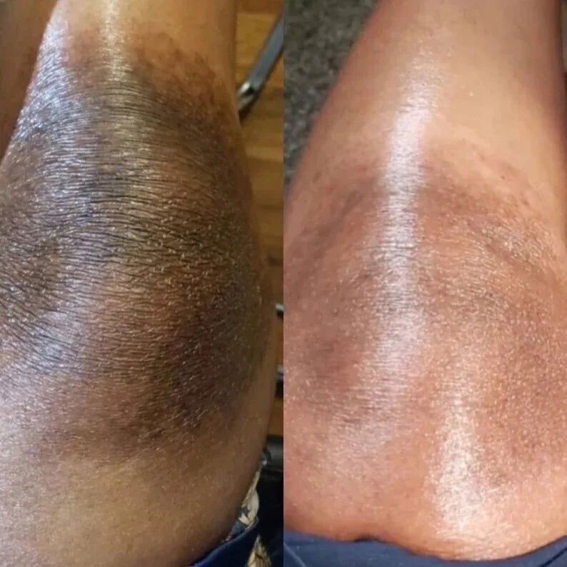 Turmeric Lemon Kojic Acid Soap Bar - YezNatural.com