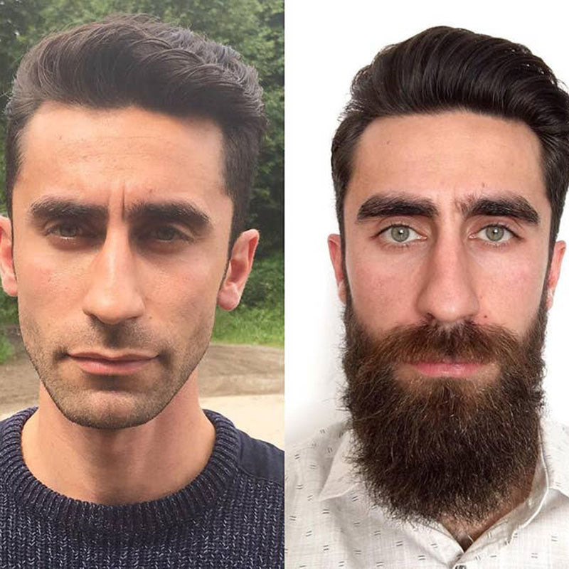 Pure Batana Beard Growth Serum Dr. Sebi Approved 🧔