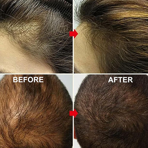 Pure Batana Serum Natural Hair Growth Oil Dr. Sebi Approved 🪔