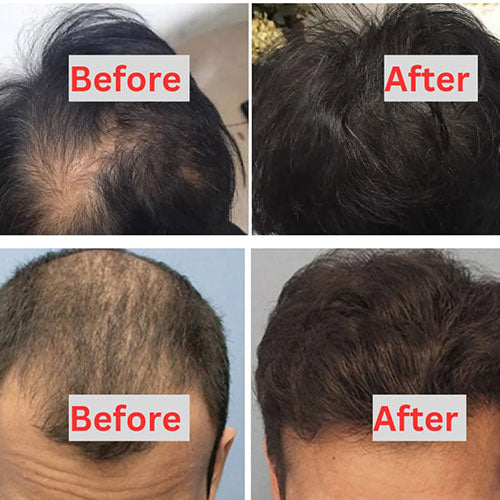 Pure Batana Serum Natural Hair Growth Oil Dr. Sebi Approved 🪔