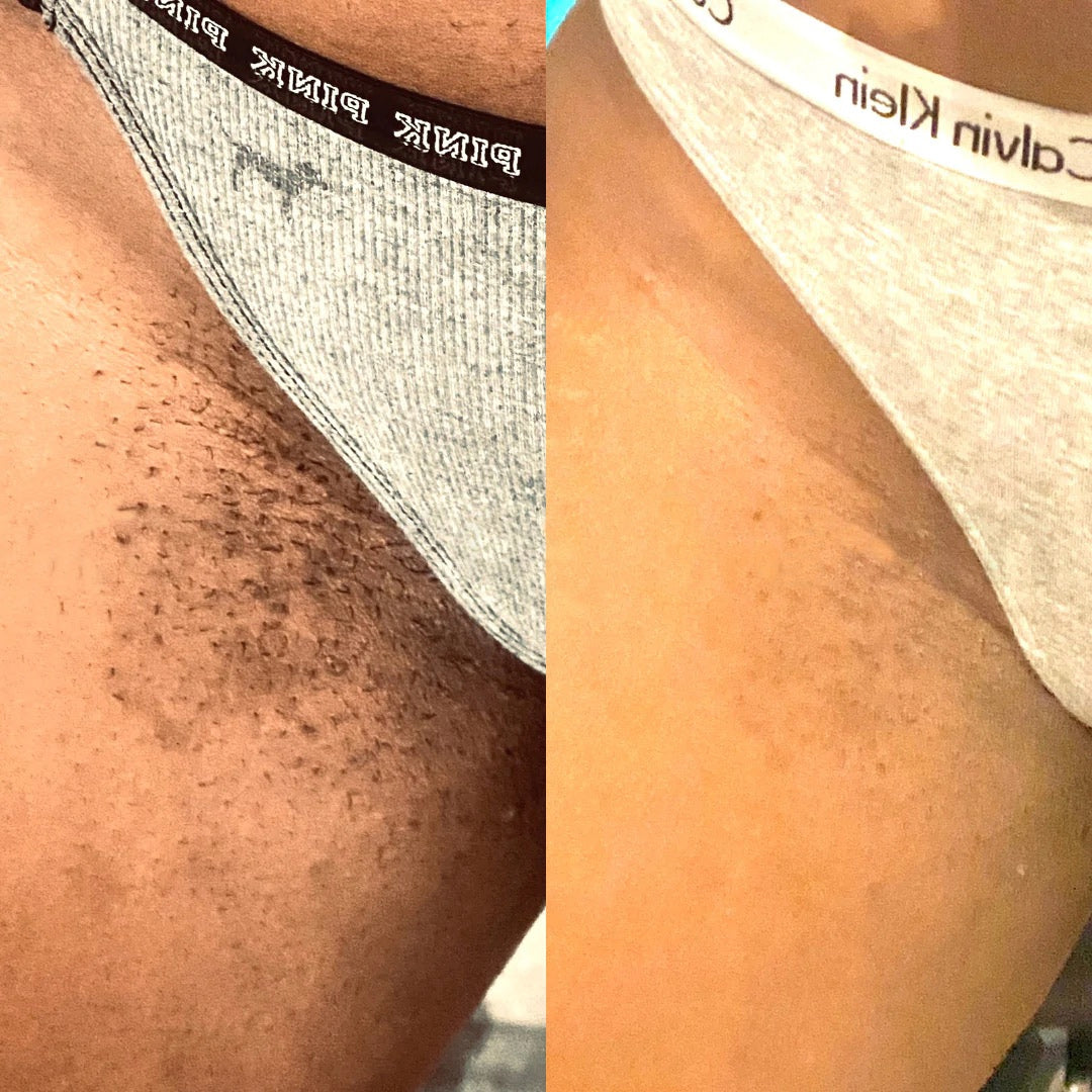 Turmeric & Strawberry Advanced Glowing | Yoni Feminine Care Oil Serum 🌿