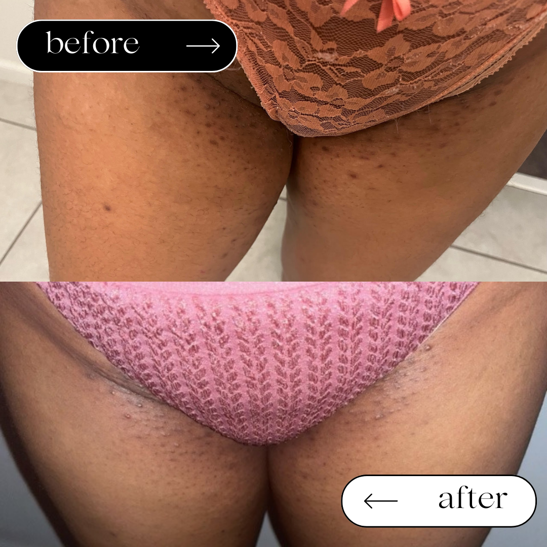 Turmeric & Strawberry Advanced Glowing | Yoni Feminine Care Oil Serum 🌿