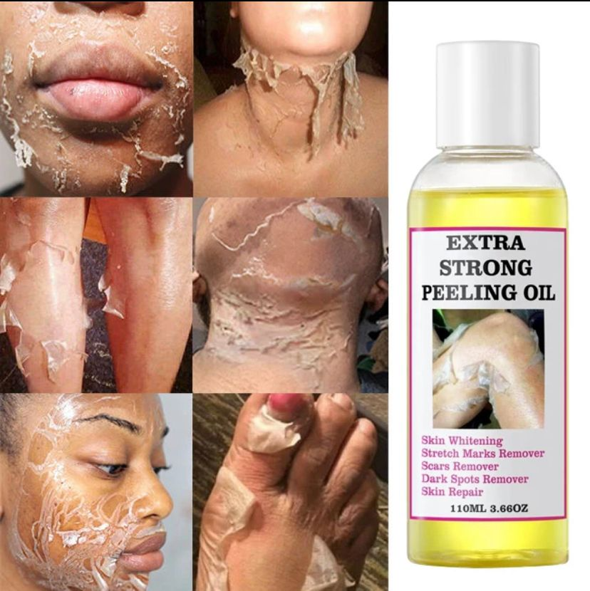 Extra Strong Yellow Peeling Brightening Oil – Radiant Skin in Days 🧡