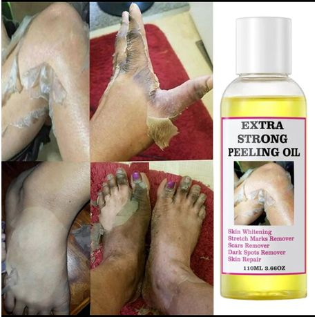 Extra Strong Yellow Peeling Brightening Oil – Radiant Skin in Days 🧡